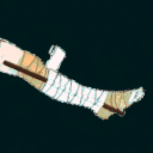 Leg, bandage, injury